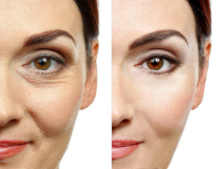 Ferrell_Cosmetics_Facial_Fillers.jpg Ferrell_Cosmetics_Facial_Fillers.jpg